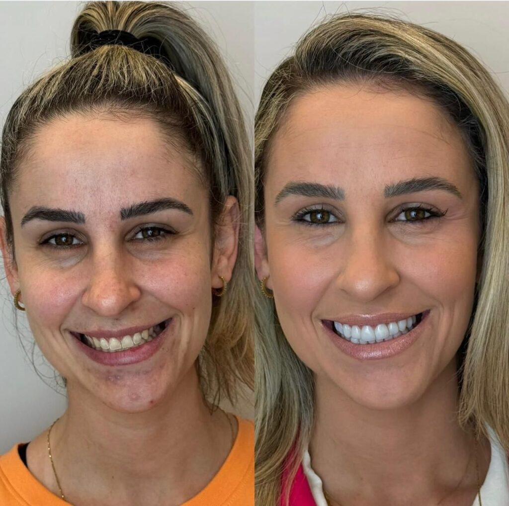 sorrisos2
